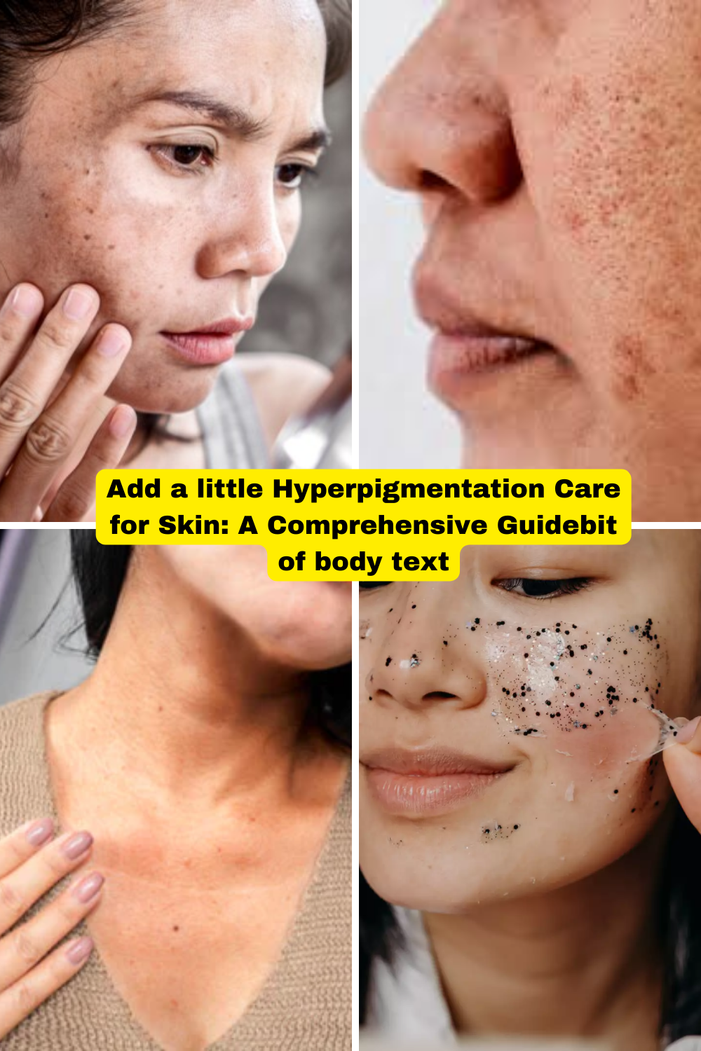 remedies for hyperpigmentation