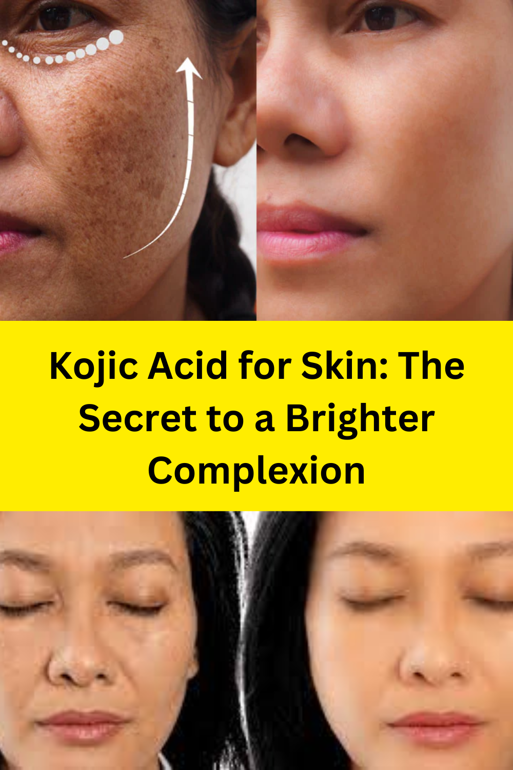 Kojic Acid for Skin: The Secret to a Brighter Complexion